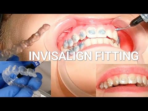 YouTube Video 7FjEfA5Jvlo